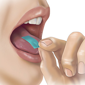A PharmFilm® medication being applied directly onto the tongue (lingual delivery)